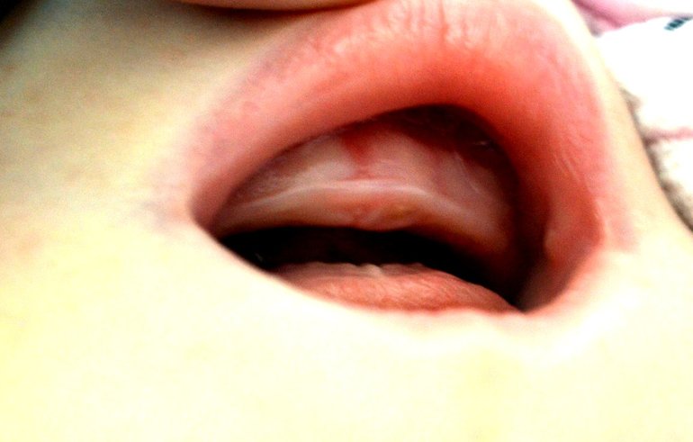 Неужели первый зуб?!