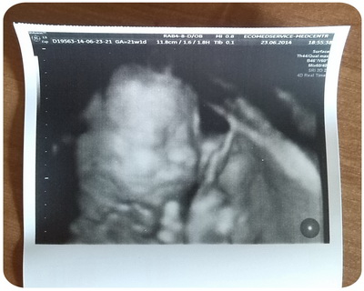 Узи 21 неделя (+фото).