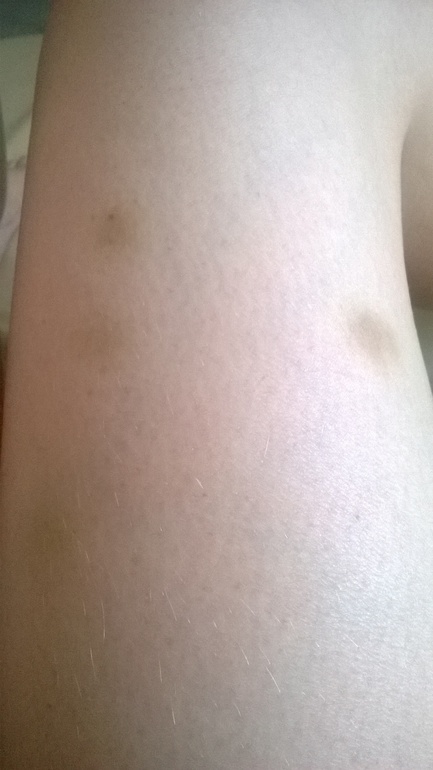 Продолжение про LPG.