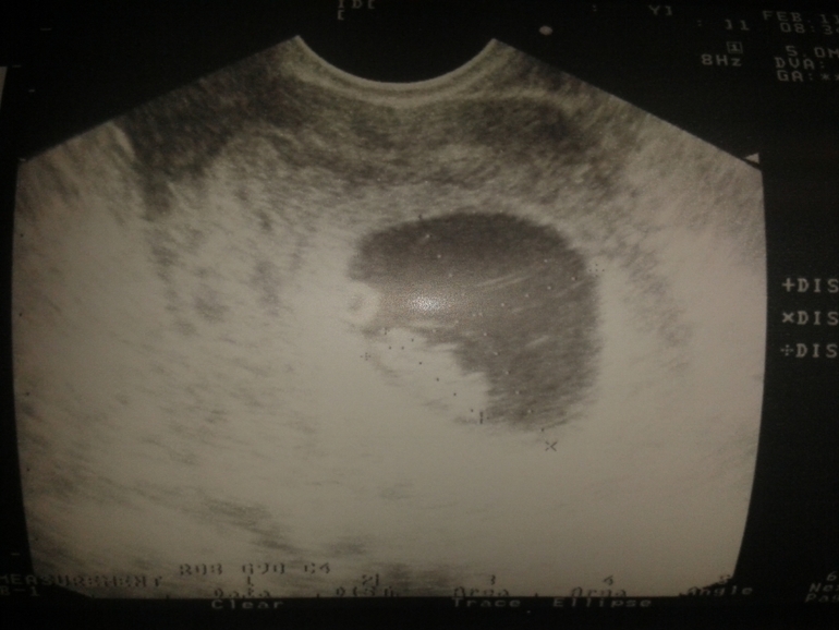 Растет моя лошадка (ну или коник)....1-й поход к врачу!