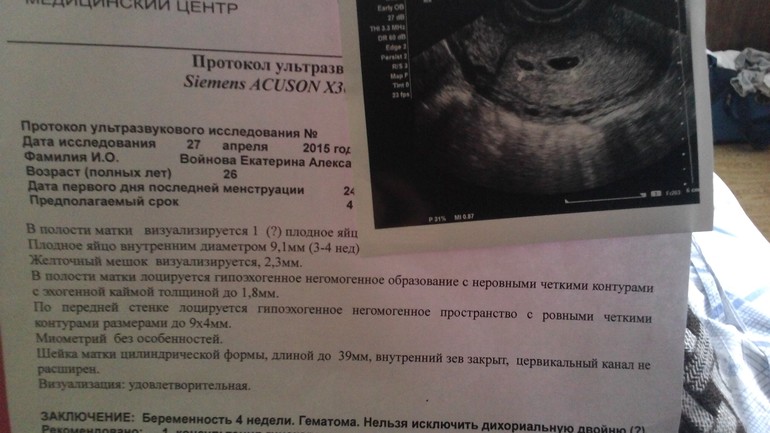 4 недели от зачатия на узи видно 4 недели от зачатия на узи видно