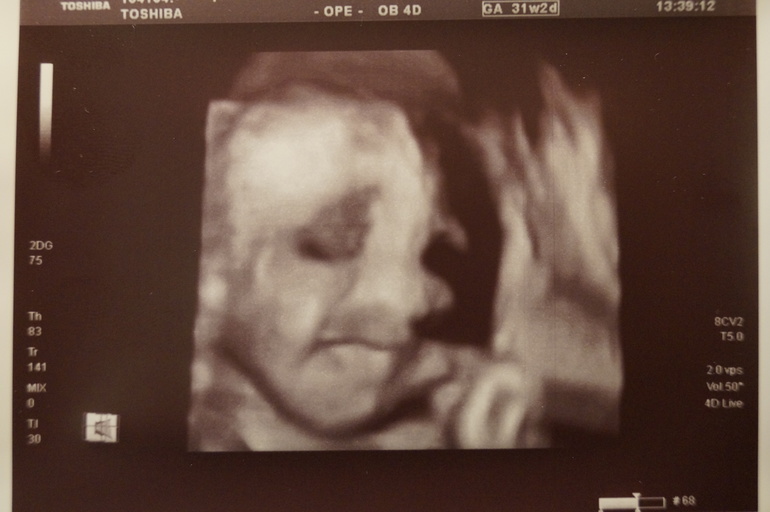 Сон мужа и результат узи.... )))))