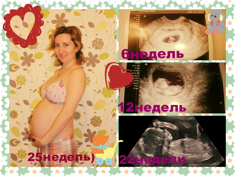 Наша 26я и мой толстопуз!))