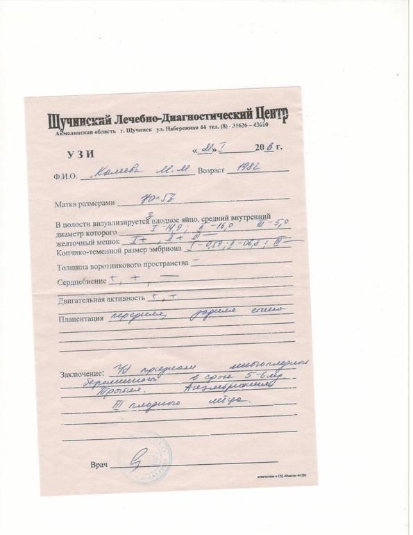 Двойня после кесарева