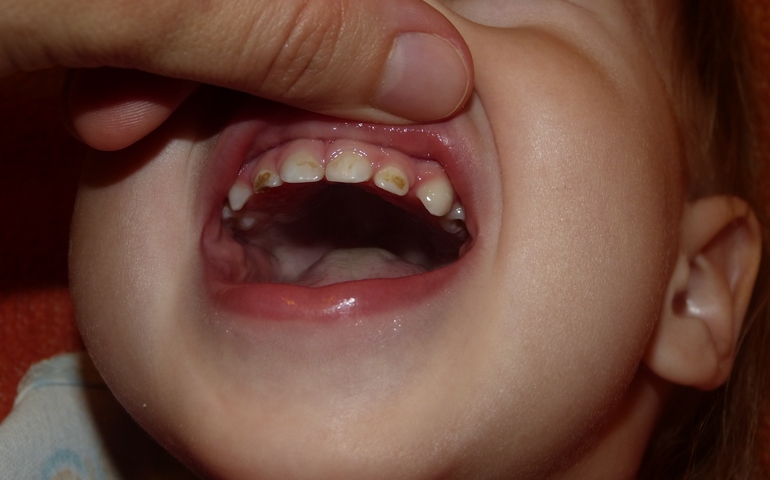 Что у нас и как это лечить? нам 1год 11мес