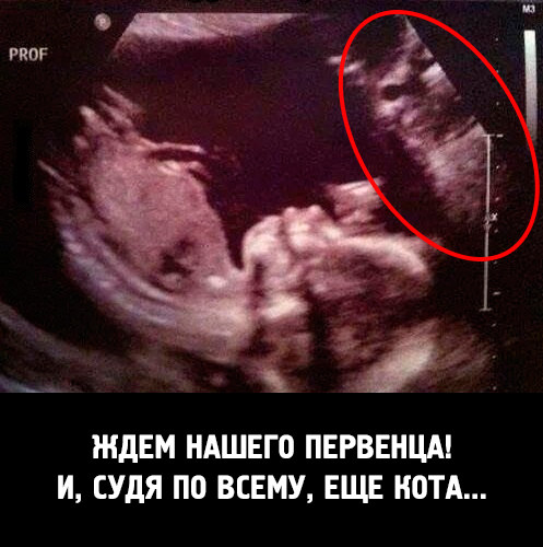 Поржать беременяшкам и просто мамам, НЕФОРМАТ