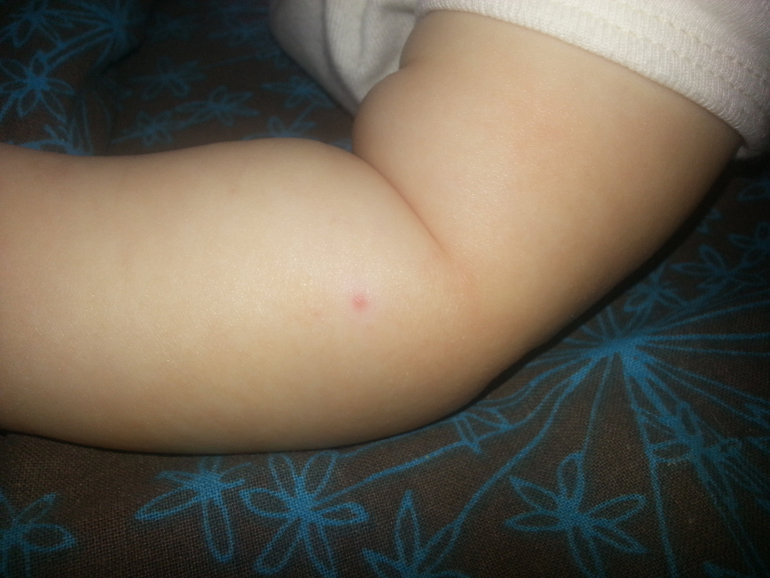 маленькие красные пятна