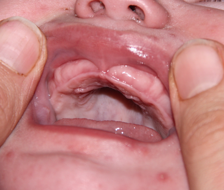 что с деснами??? Очень нужна ваша помощь!