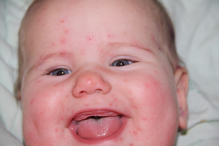 что с деснами??? Очень нужна ваша помощь!