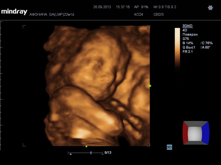 Наши супер-результаты узи)))