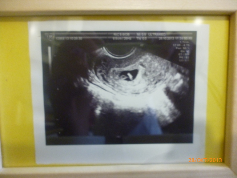 Мы начинаем)