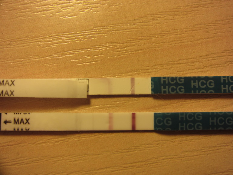 Может ли быть такое при кисте?