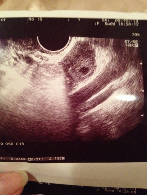 Мы познакомились)))