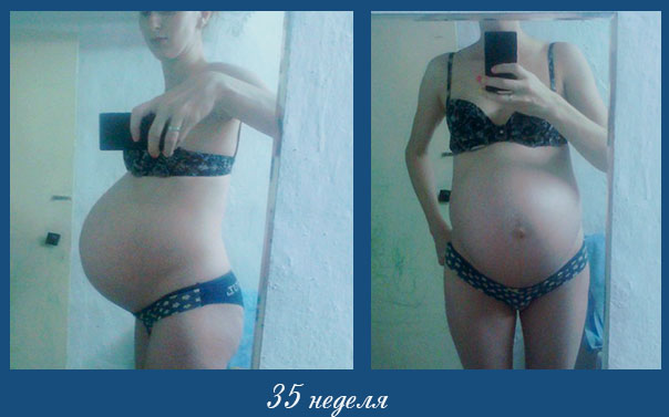 18 недель тянет живот. Тянет живот на 35 неделе беременности. Ож на 35 неделе. Окружность живота на 35 неделе.