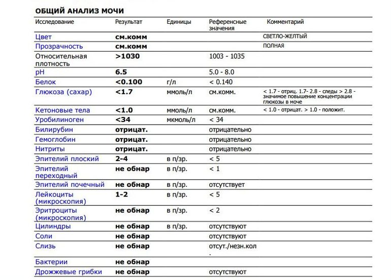 Что означает в моче у женщин. Общий анализ мочи Результаты норма. Таблица показателей общего анализа мочи у взрослых. Нормы общего анализа мочи у женщин норма. Результаты анализов мочи норма у женщин.