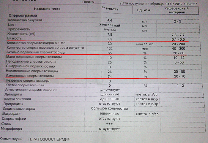 Астенозооспермия схема лечения - 83 фото