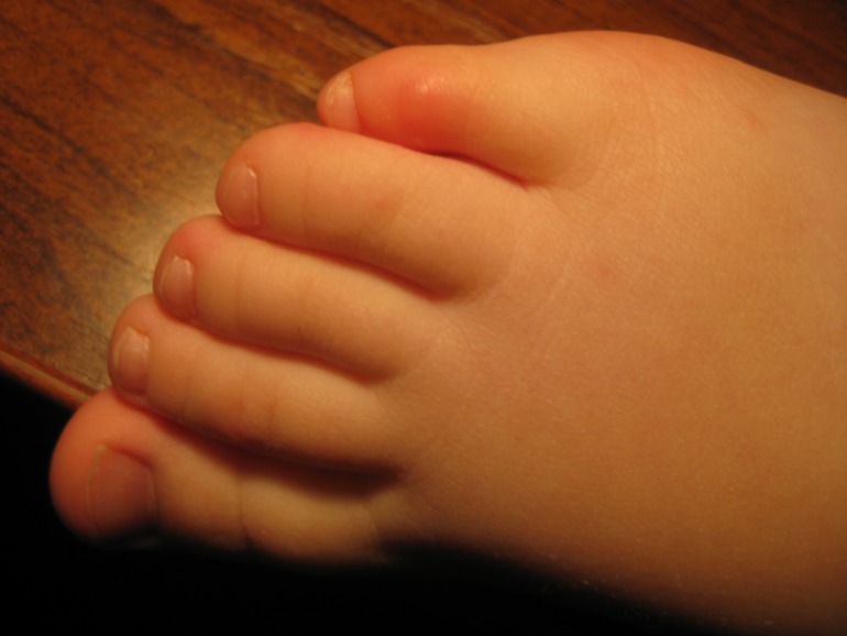 Это ветрянка?!