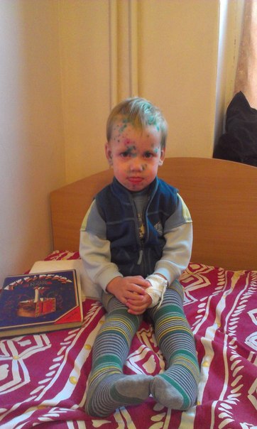 Ветрянка: две истории одной болезни...