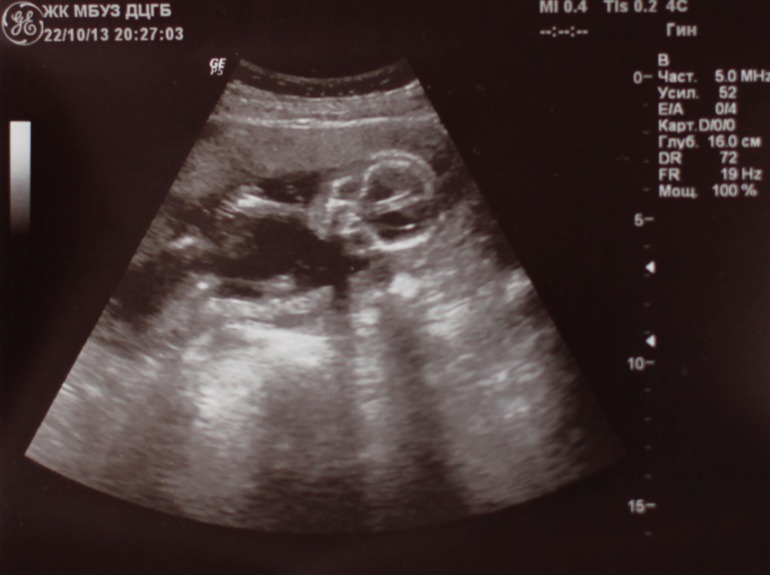 сказали на 99% девочка