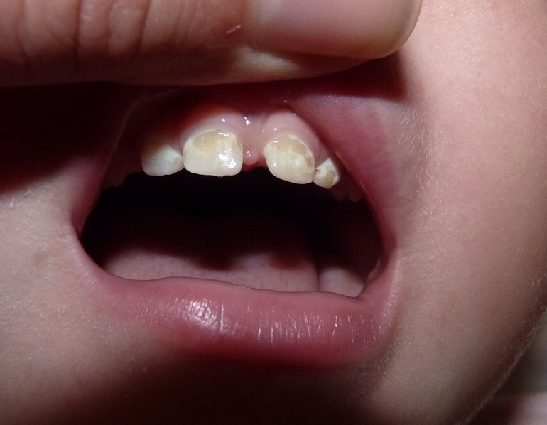 Запутались!!!