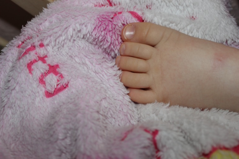 Шершавые пятна