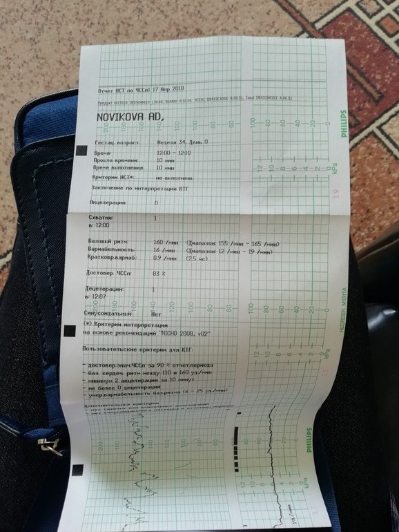 нормы ктг на 34 неделе