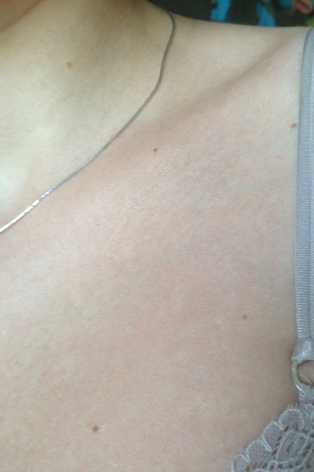 Мой опыт сведения татуировки.