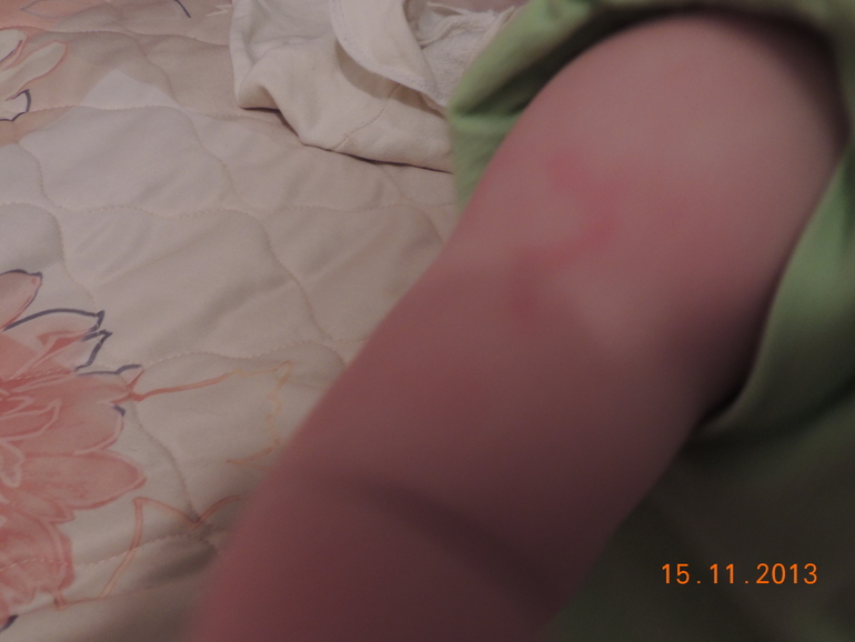 Что на нас опять напало?