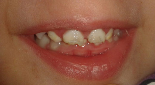 Что делать?