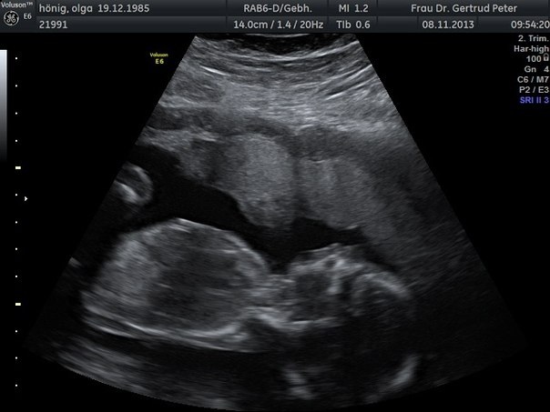 Мой сладкий мальчик!