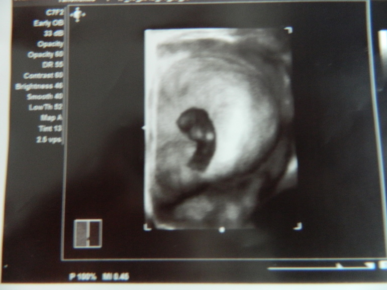 Для ВАС, дорогие, заразные вещицы))))