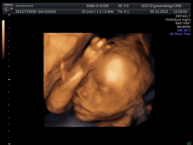 Наша умничка!!! ( немного фото)