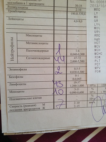 Наша медкарта попала мне в руки... ПОМОГИТЕ РАСШИФРОВАТЬ АНАЛИЗЫ!!!