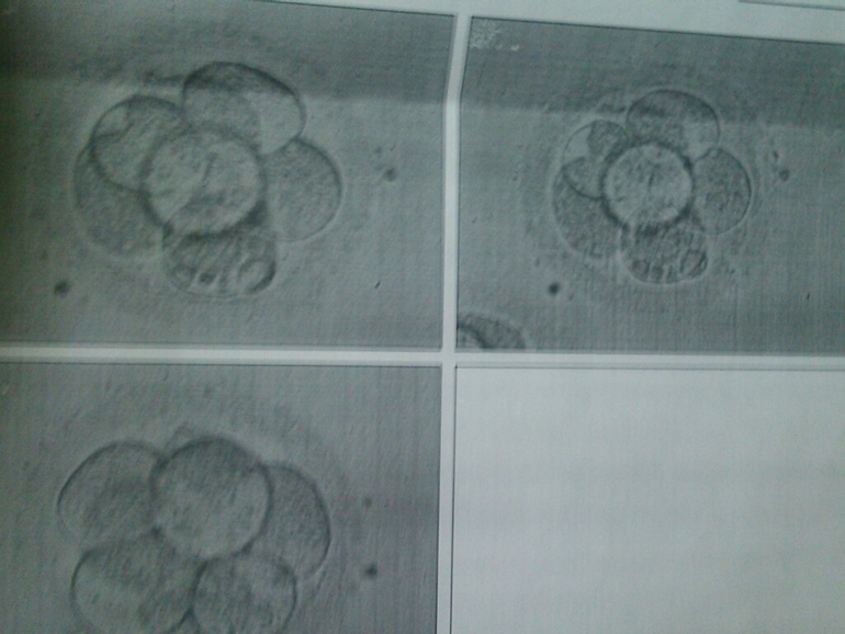 Вот мои клеточки трехдневочки)