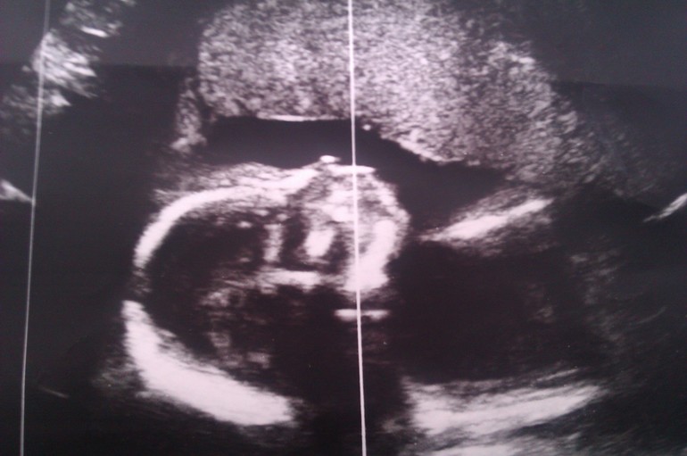 наше счастье (продолжение)