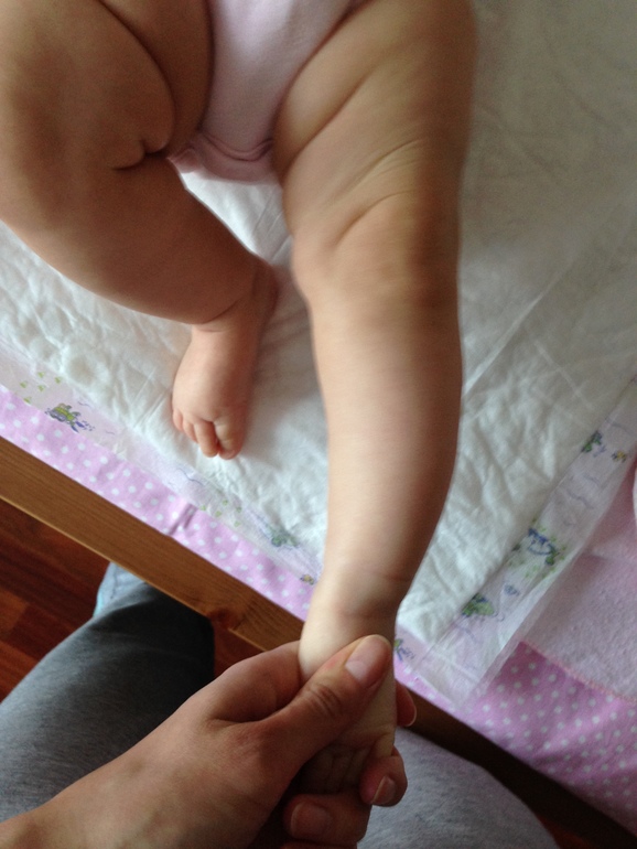 У ребенка кривые ноги: почему и что делать?