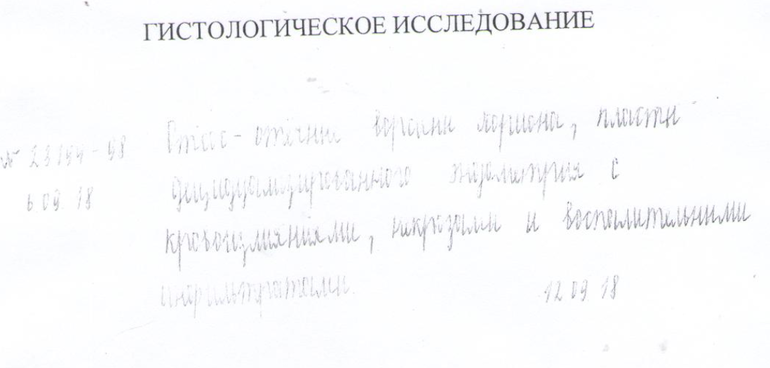 Почему результаты гистологии не говорят по телефону