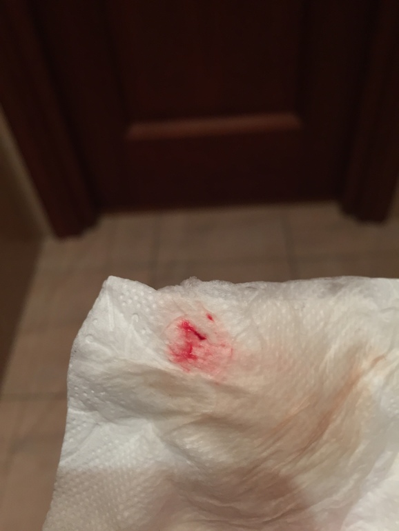 Имплантационное кровотечение — 24 ответов | форум Babyblog