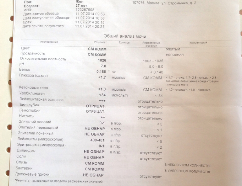 Результаты бак анализа мочи. Общий анализ мочи анализ. Общий анализ мочи. Анализ на посев мочи как сдавать. Бак посев мочи на микрофлору и чувствительность к антибиотикам.