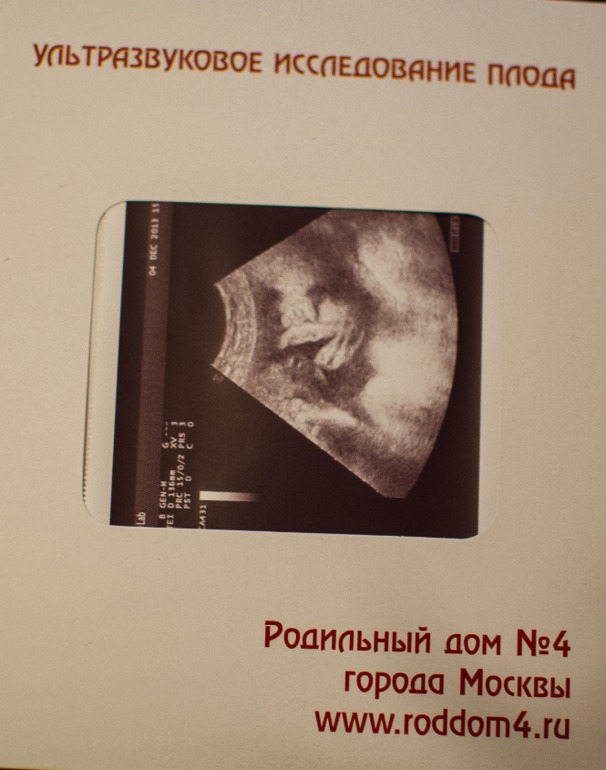 37 недель!