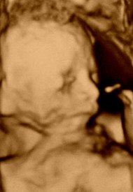 Фото УЗИ на 23 неделе беременности