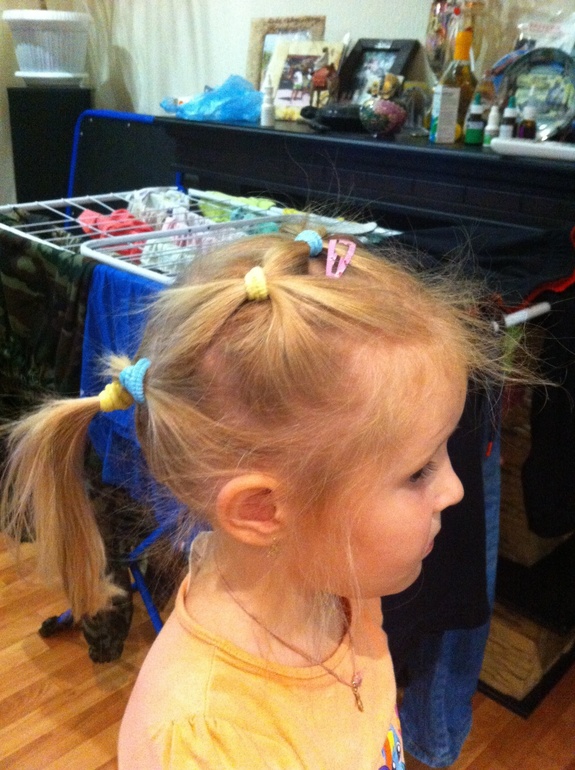 У ребенка плохие волосы. Выпадают волосы 3 месяца. У ребенка плохо растут волосы залысинами. У ребенка 3 года плохо растут волосы. Редкие волосы у ребенка 2 года.