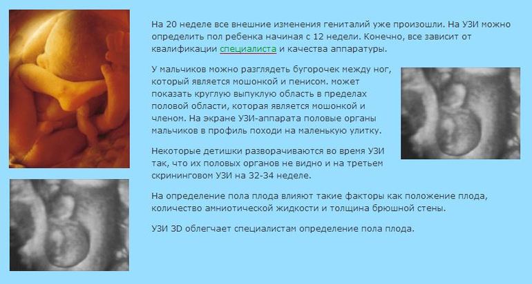 раннее определение пола