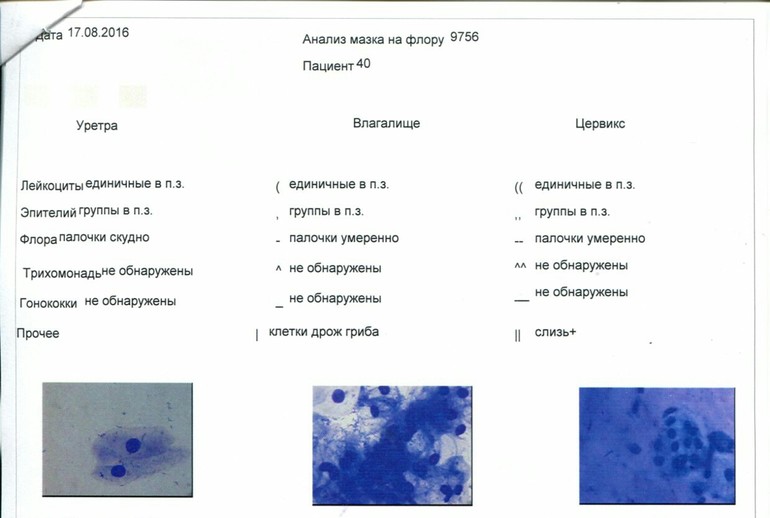 Женские мазки на флору под микроскопом фото с описанием