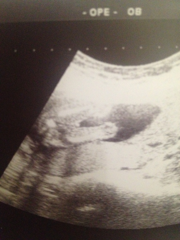 Узи и пол малыша)