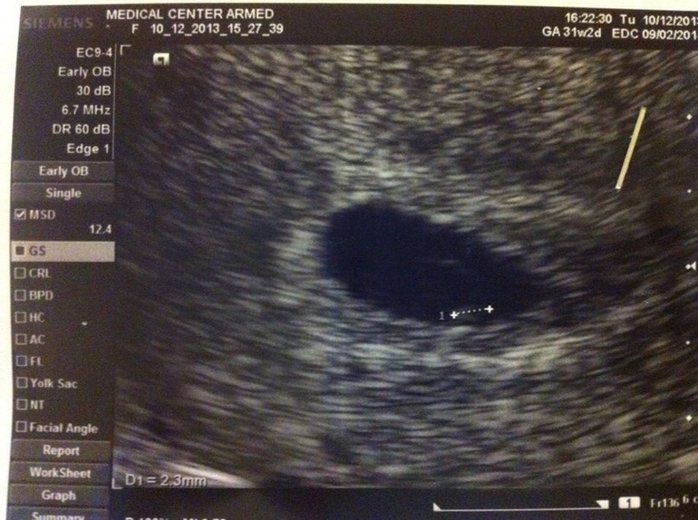 Нашлась моя козявочка! Какое счастье!!!