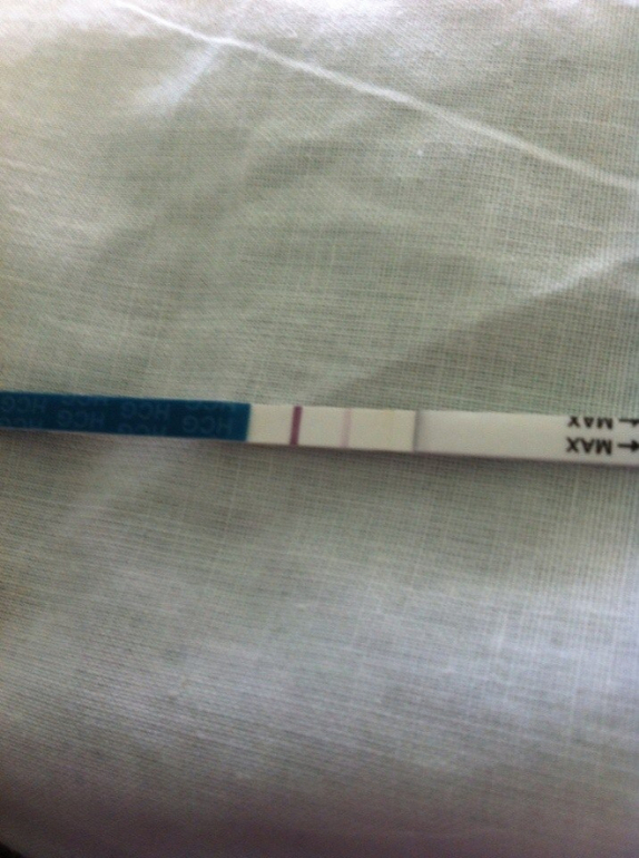 Посмотри пожалуйста, у меня в глазах что то или это 2 полосочка?