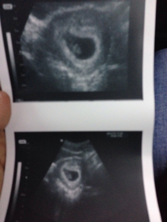 Нашей малявочке уже 8 неделек ставят!))