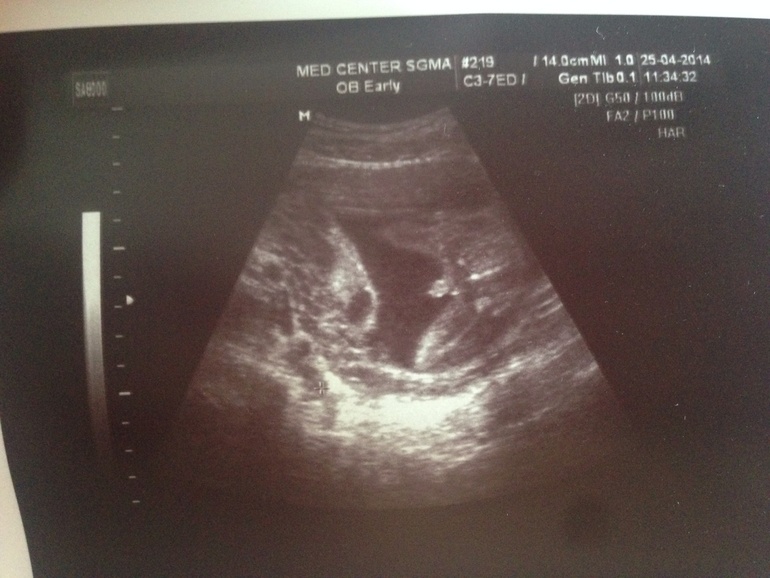 Узи 21 неделя +фото!