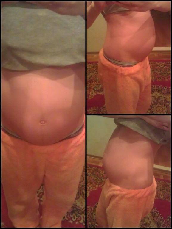 вот такие мы в 25 неделт.